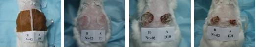 Diễn biến vết thương bỏng trên thỏ thí nghiệm trong quá trình điều trị bằng nano bạc. Các ký hiệu: vùng A – băng nano bạc điều chế; vùng B – băng Anson; No-02 – số thứ tự của thỏ thí nghiệm; D10 – ngày điều trị thứ 10