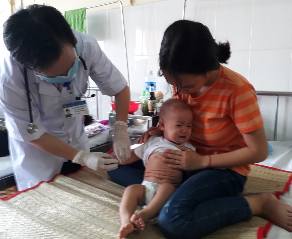 Một trẻ mắc sởi điều trị tại Khoa Nhi tổng hợp, Bệnh viện Đa khoa vùng Tây Nguyên.