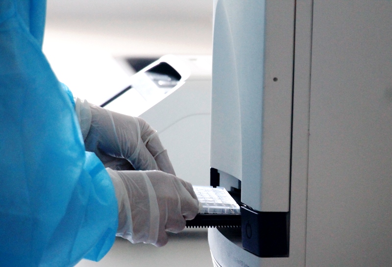 Sau khi được tách chiết các mẫu bệnh phẩm sẽ được đặt vào hệ thống Realtime PCR để phân tích