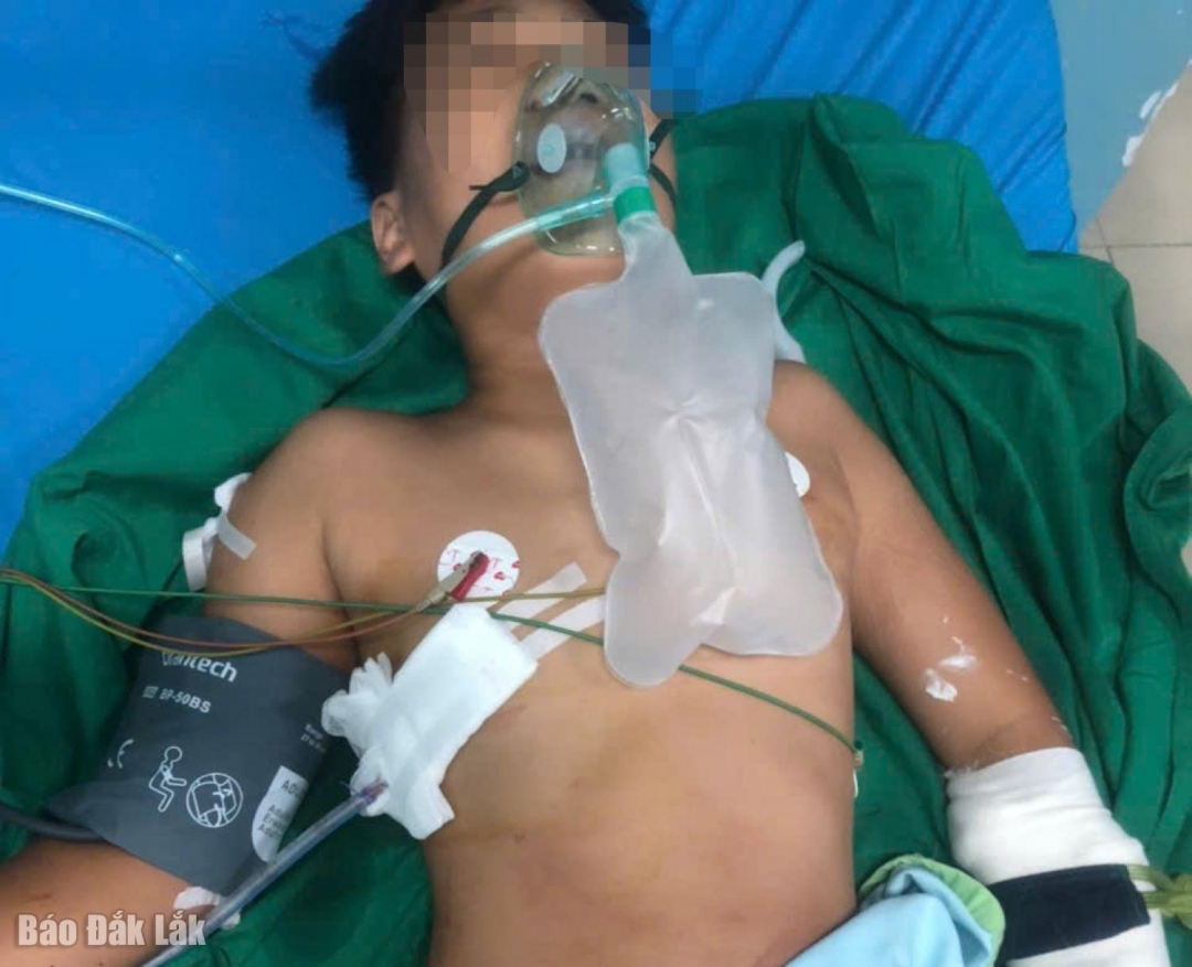 Bệnh nhân T.T.P. đang được điều trị tích cực tại Bệnh viện đa khoa vùng Tây Nguyên.