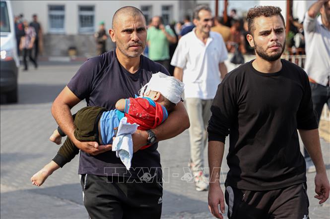 Một em nhỏ bị thương sau cuộc không kích của Israel xuống thành phố Gaza, ngày 9/10/2023. Ảnh: THX/TTXVN