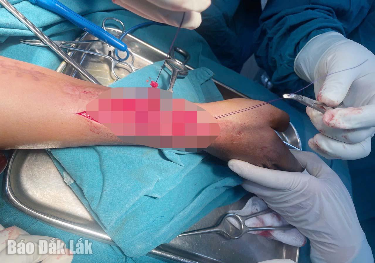 Các bác sĩ thực hiện thủ thuật chuyển gân giúp các ngón tay vận động được trở lại.