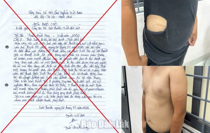 Tự gây thương tích, dựng chuyện bị cướp 40 triệu đồng để báo tin giả