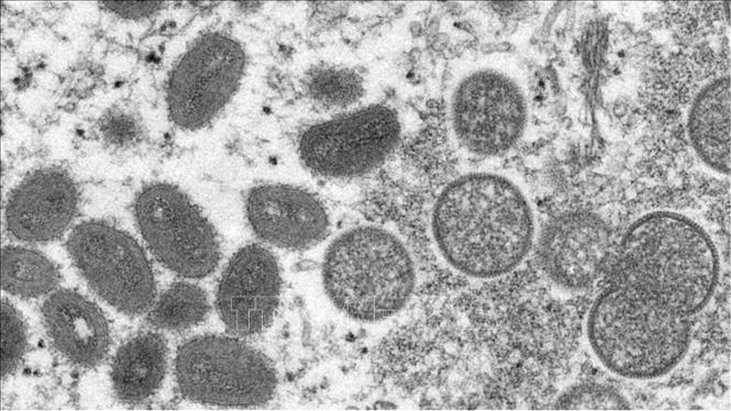  Hình ảnh dưới kính hiển vi của virus đậu mùa khỉ. Ảnh: AP/TTXVN