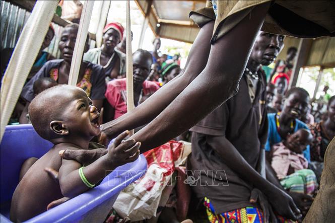Kiểm tra sức khỏe cho trẻ em suy dinh dưỡng tại Panthau, Nam Sudan. Ảnh: AFP/TTXVN