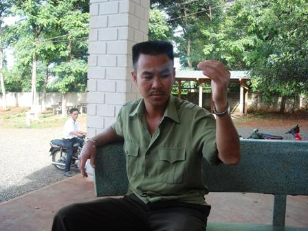 Anh Nguyễn Thanh Lộc và cánh tay bị gãy do lâm tặc hành hung khi làm nhiệm vụ.