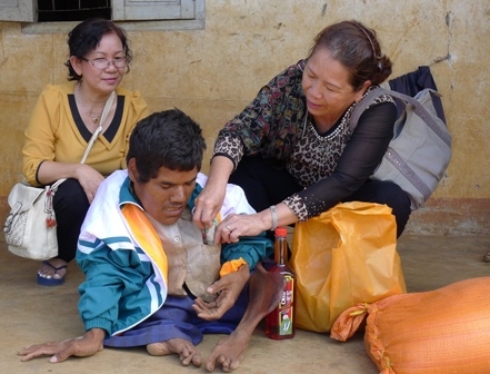 Cán bộ Hội thăm và tặng quà Y Tung Buôn Krông bị khuyết tật bẩm sinh, xương chân như rễ cây ở buôn Jiê Júk 