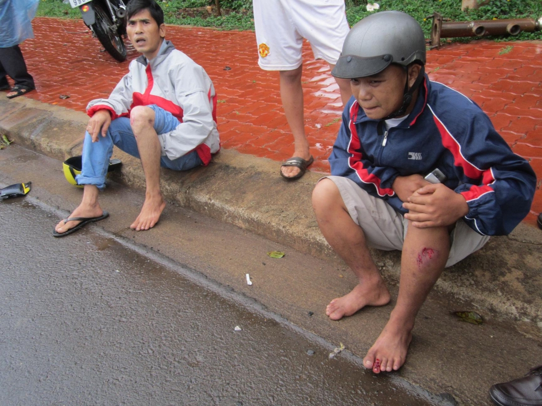 Hai thanh niên bị thương ở chân.