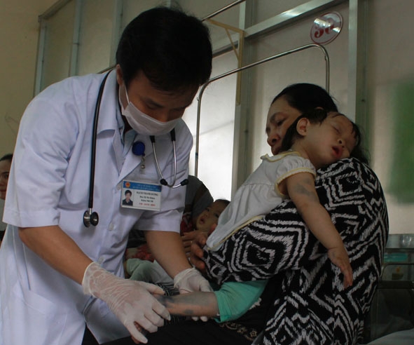 Một trường hợp trẻ mắc tay chân miệng điều trị tại Khoa Nhi tổng hợp, Bệnh viện Đa khoa tỉnh.