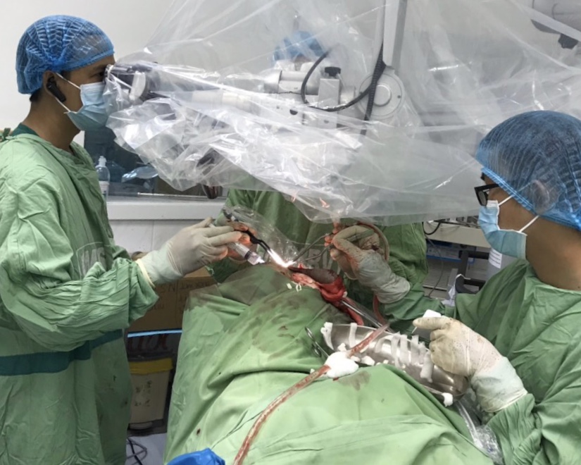 Các bác sĩ Khoa Ngoại Thần kinh Bệnh viện Đa khoa vùng Tây Nguyên đang phẫu thuật cho bệnh nhân Phàng Thị Ư